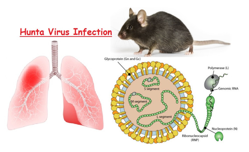 Le Hantavirus: Une Ménace Silencieuse à Bord